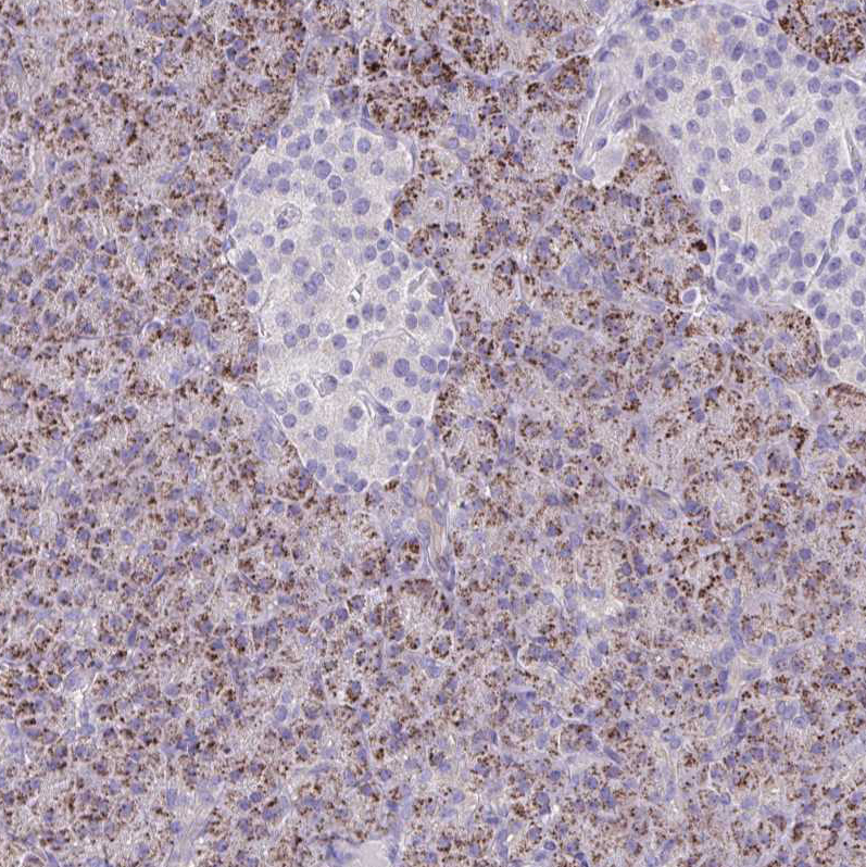 Immunohistochemistry (Formalin/PFA-fixed paraffin-embedded sections) - Anti-NNMT antibody (AB272669), expandable thumbnail