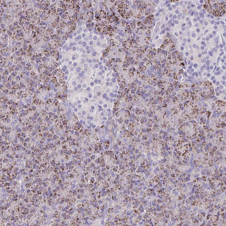 Immunohistochemistry (Formalin/PFA-fixed paraffin-embedded sections) - Anti-NNMT antibody (AB272669)