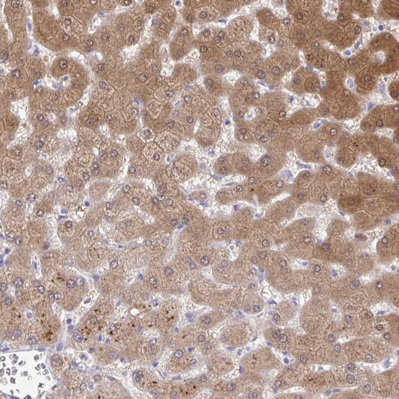 Immunohistochemistry (Formalin/PFA-fixed paraffin-embedded sections) - Anti-NNMT antibody (AB272669), expandable thumbnail