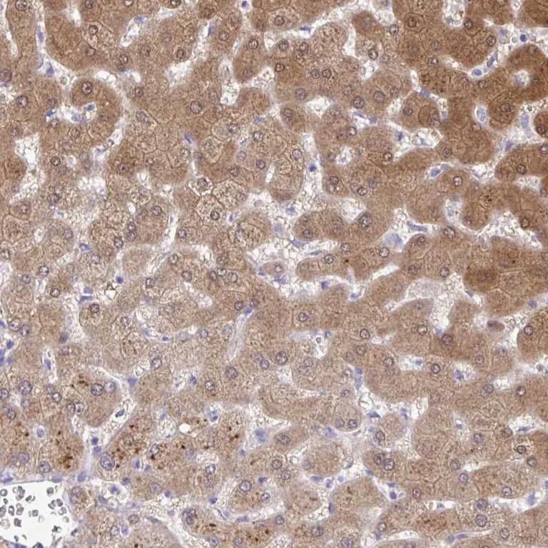 Immunohistochemistry (Formalin/PFA-fixed paraffin-embedded sections) - Anti-NNMT antibody (AB272669)