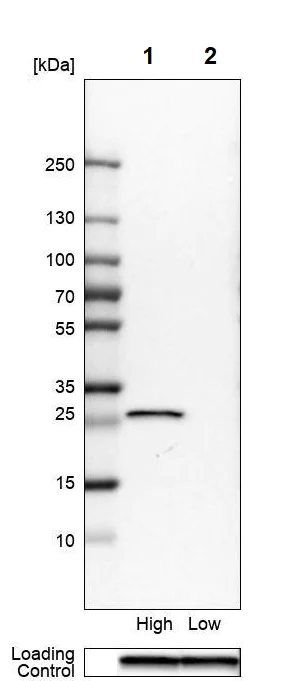 Western blot - Anti-NNMT antibody (AB272669)