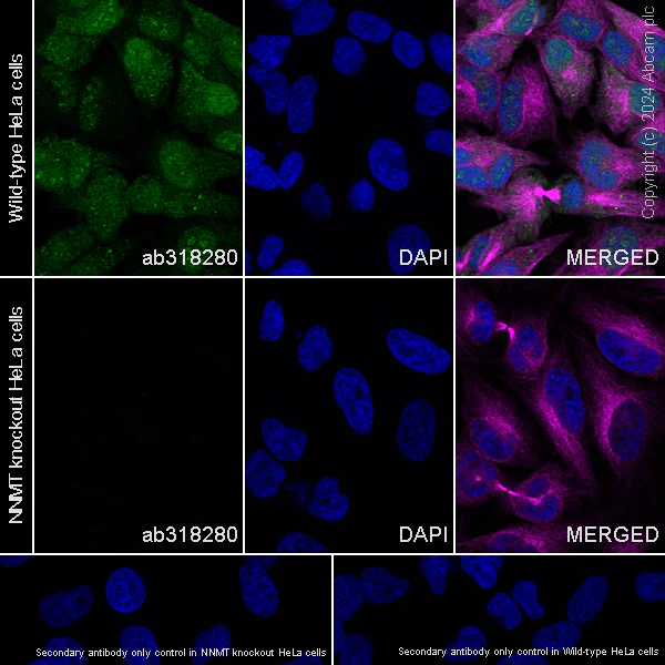 Immunocytochemistry/ Immunofluorescence - Anti-NNMT antibody [EPR29205-77] (AB318280)