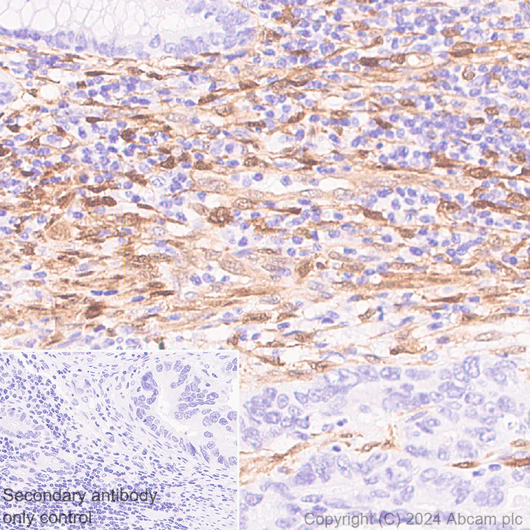 Immunohistochemistry (Formalin/PFA-fixed paraffin-embedded sections) - Anti-NNMT antibody [EPR29205-77] (AB318280)