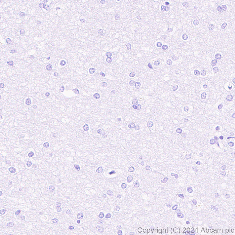 Immunohistochemistry (Formalin/PFA-fixed paraffin-embedded sections) - Anti-NNMT antibody [EPR29205-77] (AB318280)