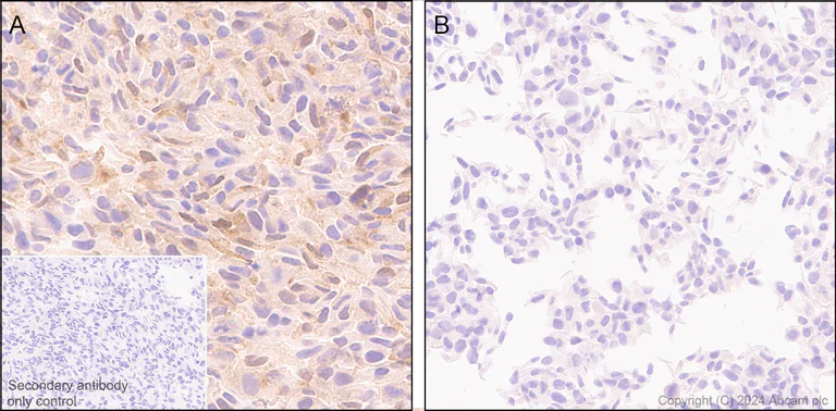 Immunohistochemistry (Formalin/PFA-fixed paraffin-embedded sections) - Anti-NNMT antibody [EPR29205-77] (AB318280)