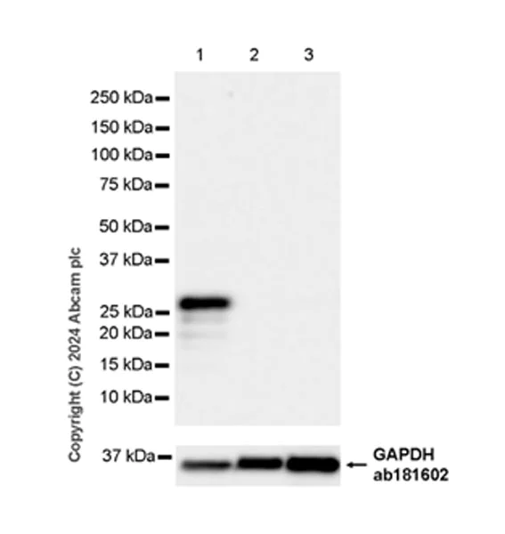 Western blot - Anti-NNMT antibody [EPR29205-77] (AB318280)