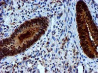 Immunohistochemistry (Formalin/PFA-fixed paraffin-embedded sections) - Anti-NNMT antibody [OTI3D8] (AB119758)
