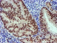Immunohistochemistry (Formalin/PFA-fixed paraffin-embedded sections) - Anti-NNMT antibody [OTI3D8] (AB119758)