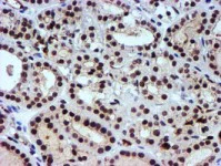 Immunohistochemistry (Formalin/PFA-fixed paraffin-embedded sections) - Anti-NNMT antibody [OTI3D8] (AB119758)