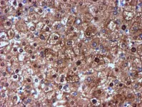 Immunohistochemistry (Formalin/PFA-fixed paraffin-embedded sections) - Anti-NNMT antibody [OTI3D8] (AB119758)