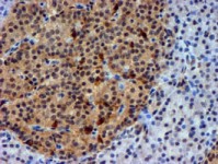 Anti-NNMT antibody [OTI3D8] Mouse monoclonal (ab119758) | Abcam