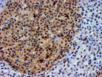 Immunohistochemistry (Formalin/PFA-fixed paraffin-embedded sections) - Anti-NNMT antibody [OTI3D8] (AB119758)
