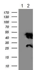 Western blot - Anti-NNMT antibody [OTI3D8] (AB119758)
