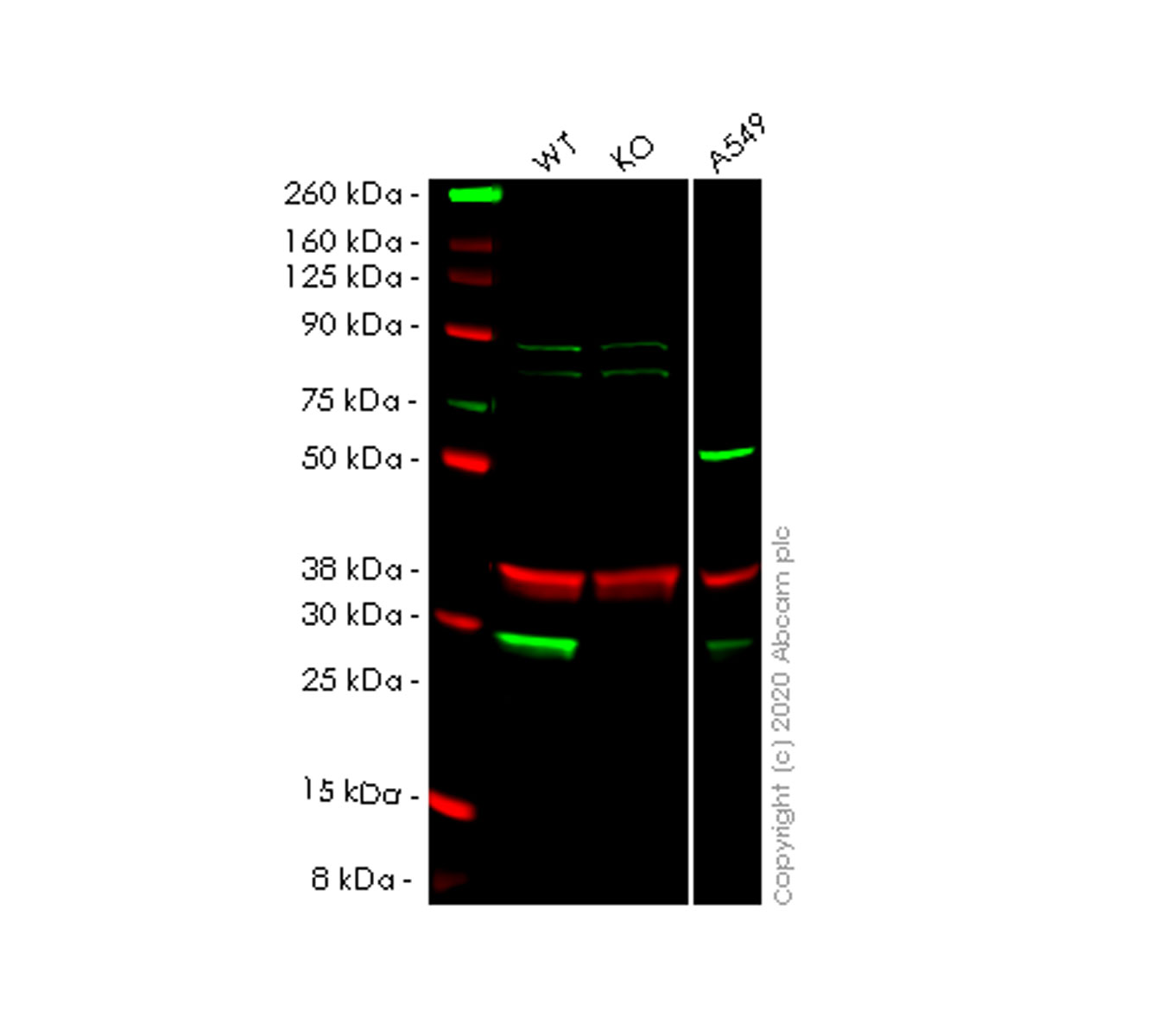 Western blot - Anti-NNMT antibody [OTI3D8] (AB119758)