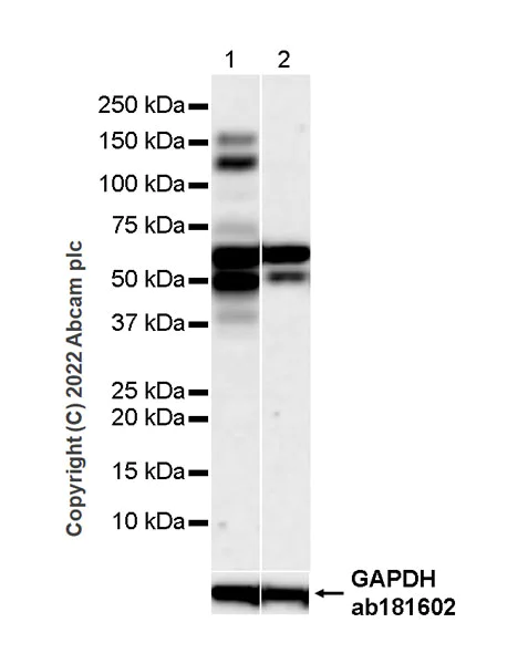 Western blot - Anti-nNOS (neuronal) antibody [16/nNOS/NOS Type I] (AB307562)