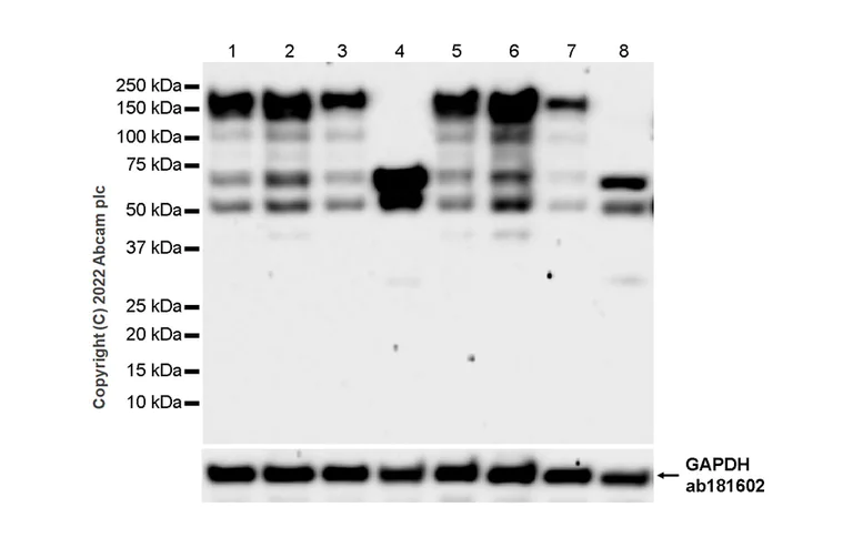 Western blot - Anti-nNOS (neuronal) antibody [16/nNOS/NOS Type I] (AB307562)