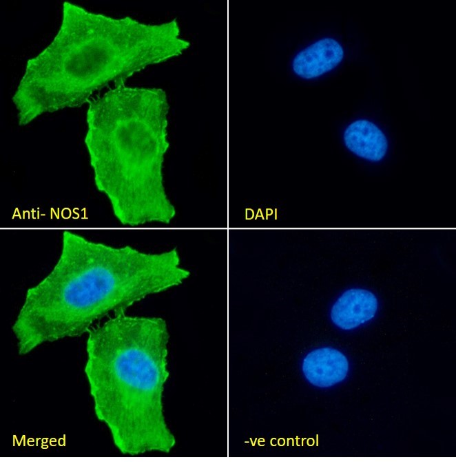 Immunocytochemistry/ Immunofluorescence - Anti-nNOS (neuronal) antibody (AB1376), expandable thumbnail