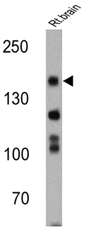Western blot - Anti-nNOS (neuronal) antibody (AB5586)