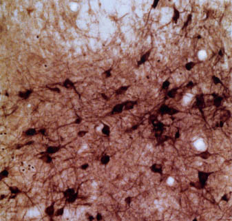 Immunohistochemistry (Frozen sections) - Anti-nNOS (neuronal) antibody (AB6175)
