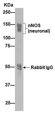 Anti-nNOS (neuronal) antibody [EP1855Y]