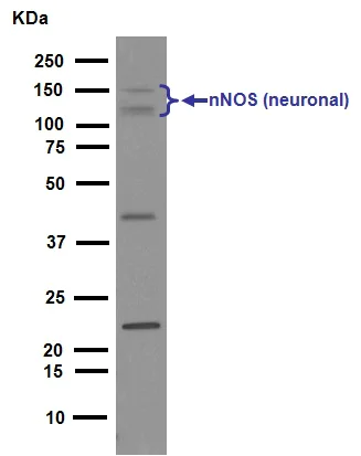 Western blot - Anti-nNOS (neuronal) antibody [EP1855Y] (AB76067)