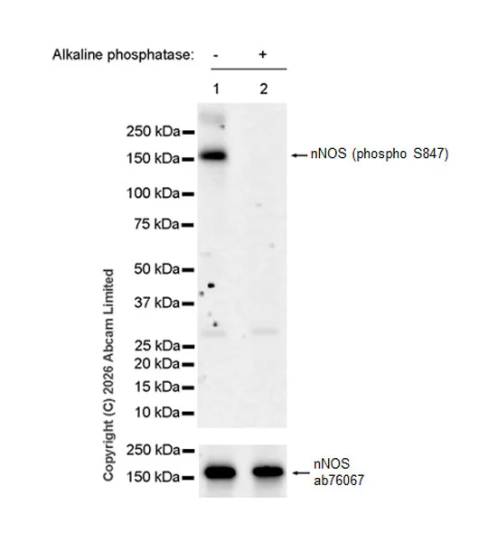 Western blot - Anti-nNOS (neuronal) antibody [EP1855Y] (AB76067)