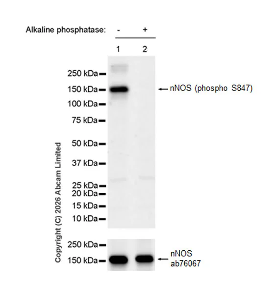 Western blot - Anti-nNOS (neuronal) antibody [EP1855Y] (AB76067)