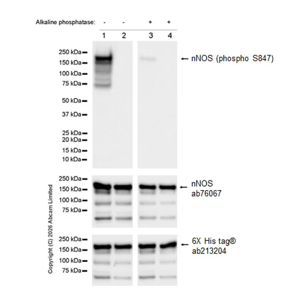 Western blot - Anti-nNOS (neuronal) antibody [EP1855Y] (AB76067)