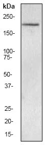 Western blot - Anti-nNOS (neuronal) antibody [EP1855Y] (AB76067)