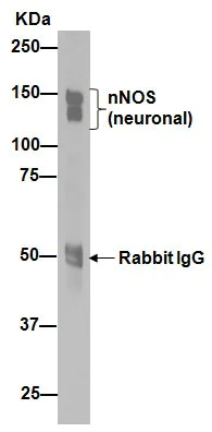 Immunoprecipitation - Anti-nNOS (neuronal) antibody [EP1855Y] - Low endotoxin, Azide free (AB219373)