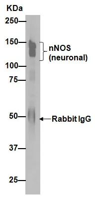 Immunoprecipitation - Anti-nNOS (neuronal) antibody [EP1855Y] - Low endotoxin, Azide free (AB219373)