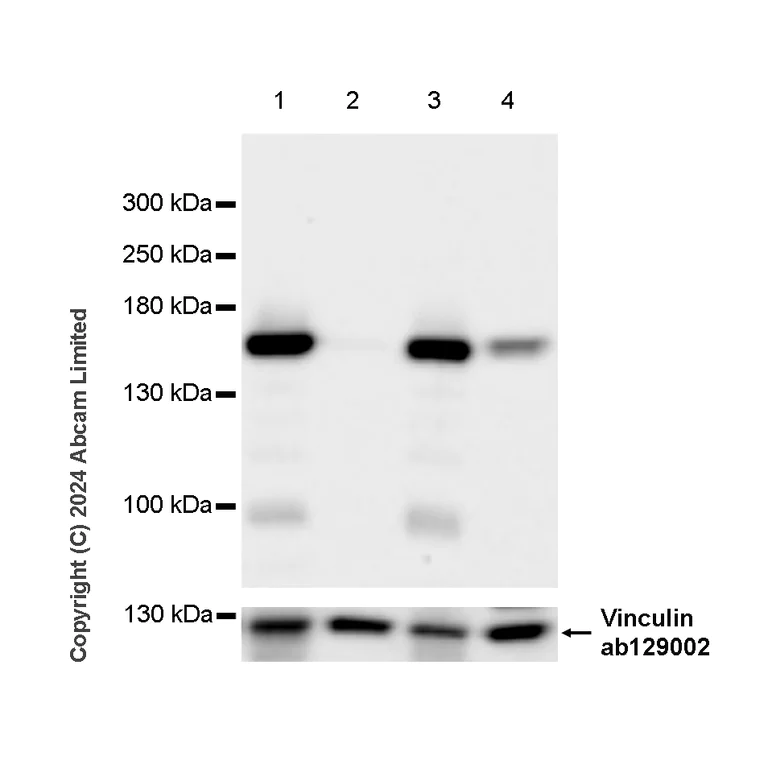 Western blot - Anti-nNOS (neuronal) antibody [EPR20372-243] - BSA and Azide free (Detector) (AB245012)