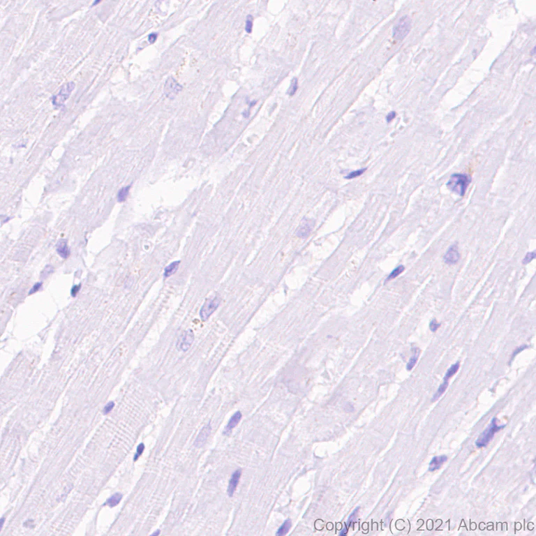 Immunohistochemistry (Formalin/PFA-fixed paraffin-embedded sections) - Anti-nNOS (neuronal) antibody [EPR24351-6] (AB270958)