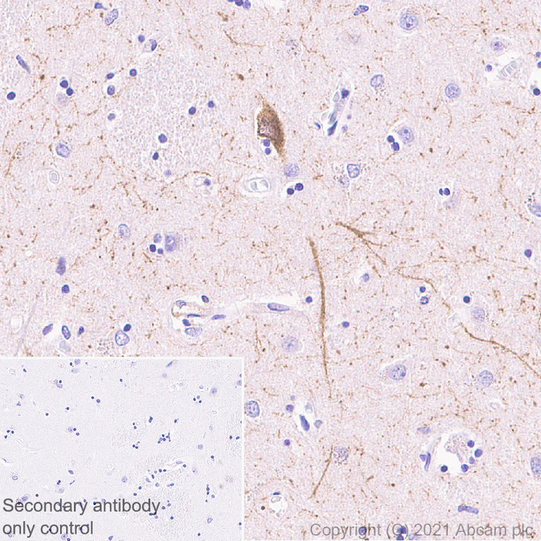 Immunohistochemistry (Formalin/PFA-fixed paraffin-embedded sections) - Anti-nNOS (neuronal) antibody [EPR24351-6] (AB270958)