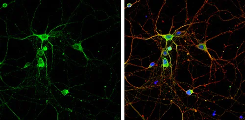 Immunocytochemistry/ Immunofluorescence - Anti-nNOS (neuronal) antibody - N-terminal (AB229785)
