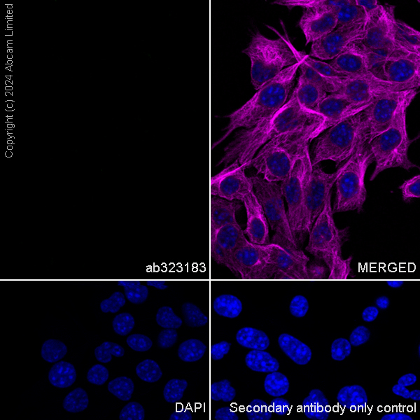 Immunocytochemistry/ Immunofluorescence - Anti-nNOS (neuronal) antibody [RM1237] (ab323183), expandable thumbnail
