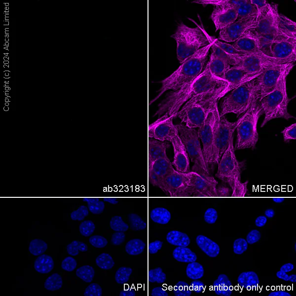 Immunocytochemistry/ Immunofluorescence - Anti-nNOS (neuronal) antibody [RM1237] (AB323183)