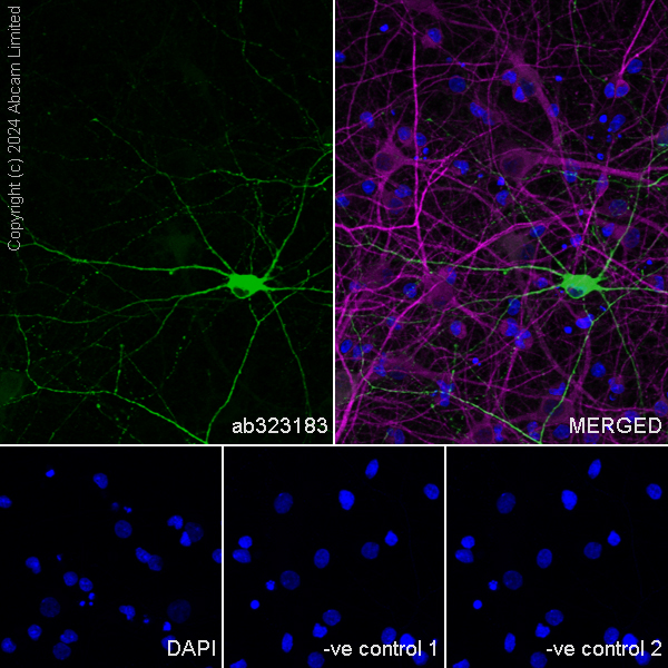 Immunocytochemistry/ Immunofluorescence - Anti-nNOS (neuronal) antibody [RM1237] (ab323183), expandable thumbnail
