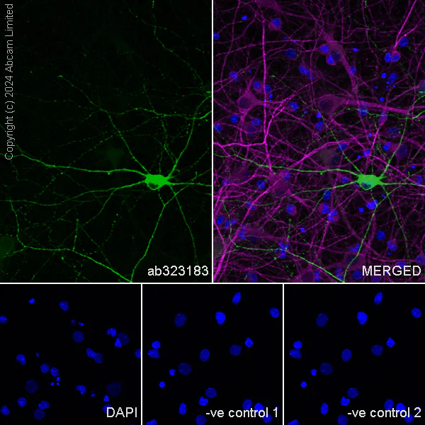Immunocytochemistry/ Immunofluorescence - Anti-nNOS (neuronal) antibody [RM1237] (AB323183)