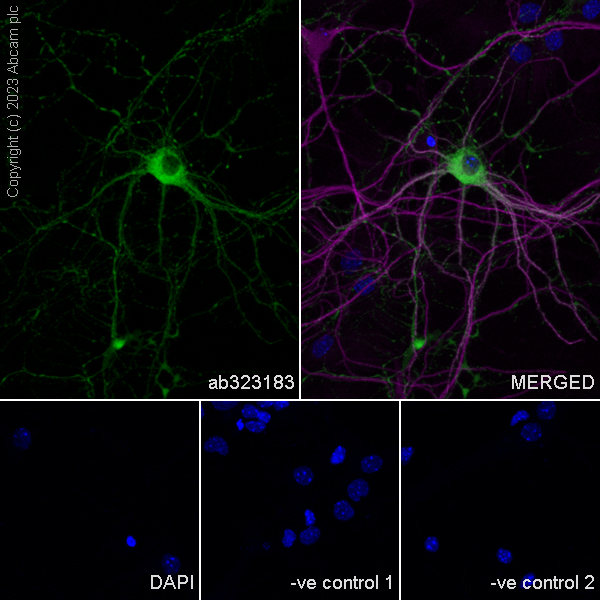 Immunocytochemistry/ Immunofluorescence - Anti-nNOS (neuronal) antibody [RM1237] (ab323183), expandable thumbnail