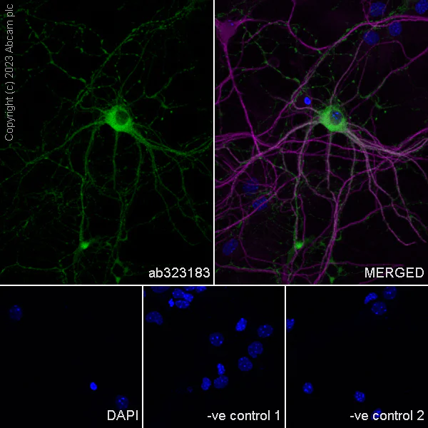 Immunocytochemistry/ Immunofluorescence - Anti-nNOS (neuronal) antibody [RM1237] (AB323183)