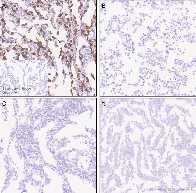 Immunohistochemistry (Formalin/PFA-fixed paraffin-embedded sections) - Anti-nNOS (neuronal) antibody [RM1237] (AB323183)