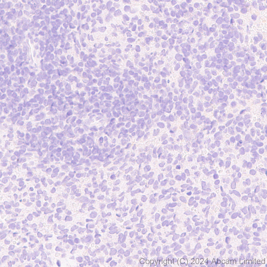 Immunohistochemistry (Formalin/PFA-fixed paraffin-embedded sections) - Anti-nNOS (neuronal) antibody [RM1237] (ab323183), expandable thumbnail