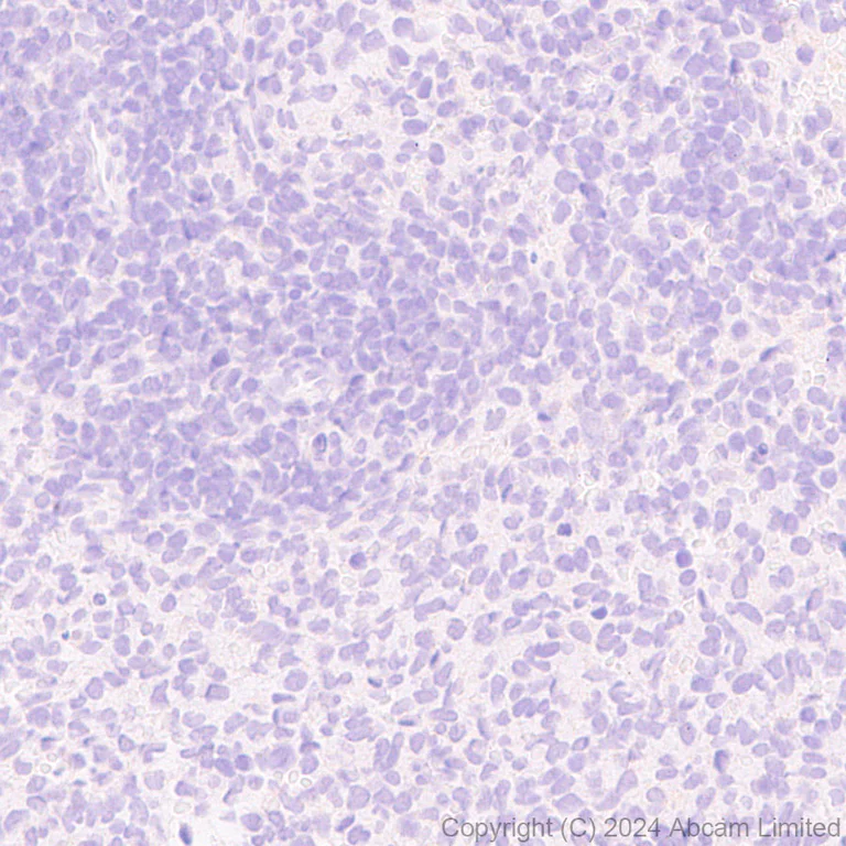 Immunohistochemistry (Formalin/PFA-fixed paraffin-embedded sections) - Anti-nNOS (neuronal) antibody [RM1237] (AB323183)