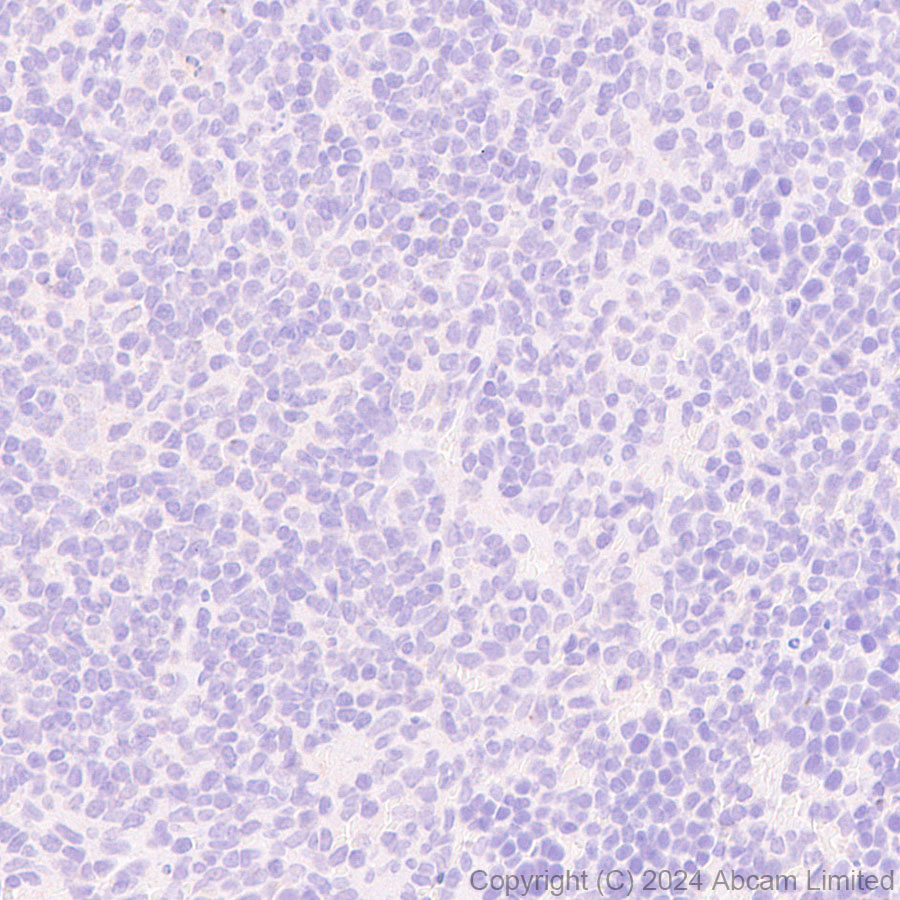 Immunohistochemistry (Formalin/PFA-fixed paraffin-embedded sections) - Anti-nNOS (neuronal) antibody [RM1237] (ab323183), expandable thumbnail