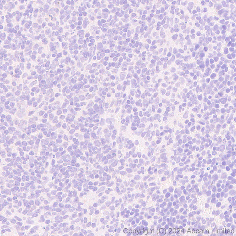 Immunohistochemistry (Formalin/PFA-fixed paraffin-embedded sections) - Anti-nNOS (neuronal) antibody [RM1237] (AB323183)