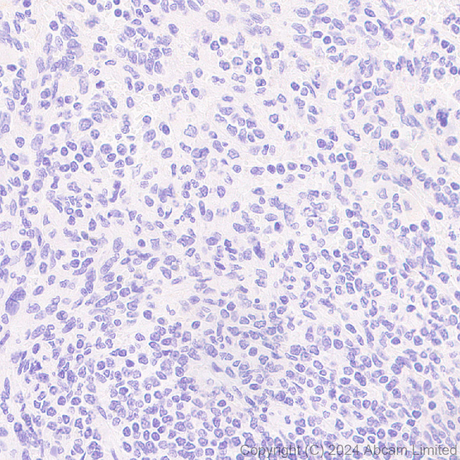 Immunohistochemistry (Formalin/PFA-fixed paraffin-embedded sections) - Anti-nNOS (neuronal) antibody [RM1237] (AB323183), expandable thumbnail