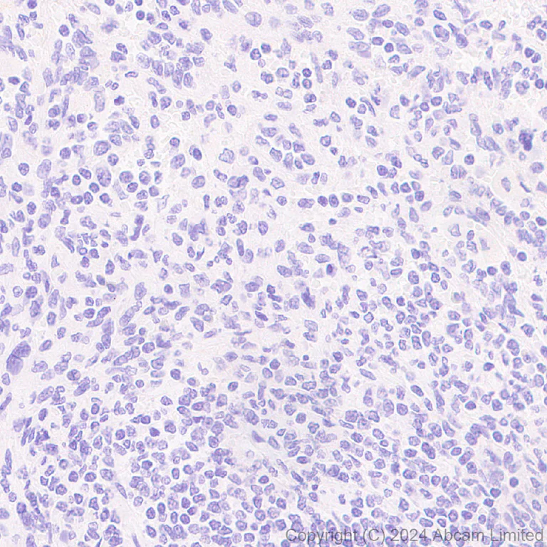 Immunohistochemistry (Formalin/PFA-fixed paraffin-embedded sections) - Anti-nNOS (neuronal) antibody [RM1237] (AB323183)