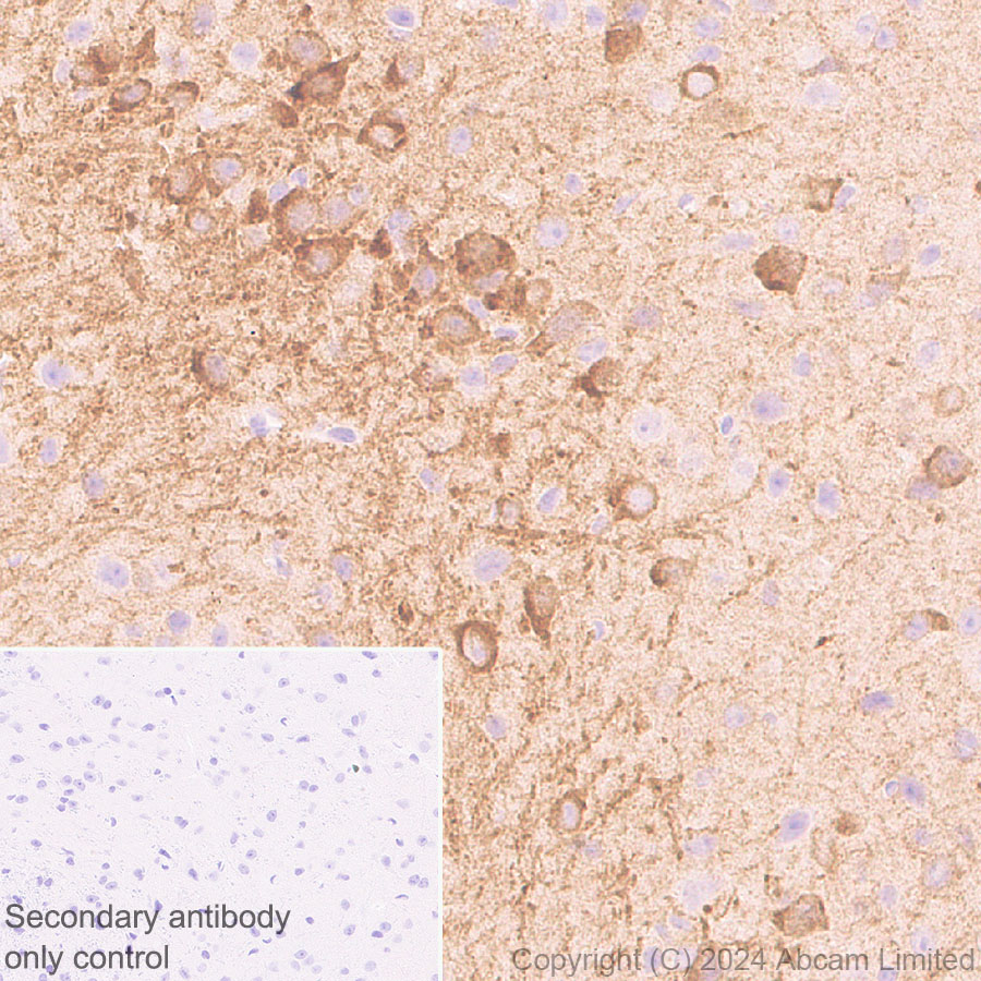 Immunohistochemistry (Formalin/PFA-fixed paraffin-embedded sections) - Anti-nNOS (neuronal) antibody [RM1237] (AB323183), expandable thumbnail