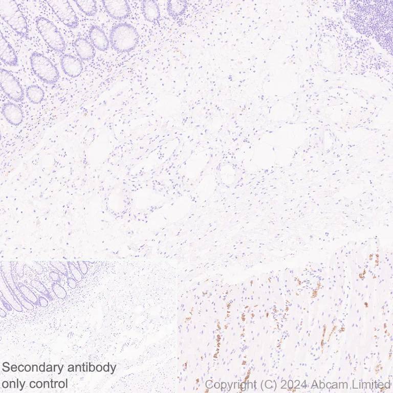 Immunohistochemistry (Formalin/PFA-fixed paraffin-embedded sections) - Anti-nNOS (neuronal) antibody [RM1237] (AB323183)